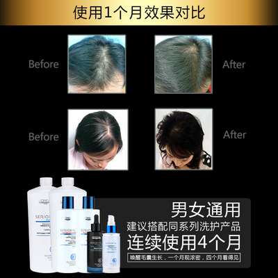 科技賦能防脫，歐萊雅芯基源洗護(hù)套裝 深入發(fā)芯，重塑強(qiáng)韌發(fā)絲